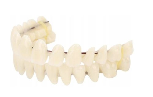 IMPLANTATI ZA ZUBE OD SMOLE A2