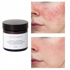 LJUBAVNA LJEKARNA Umirujuća mast s nevenom i arnikom