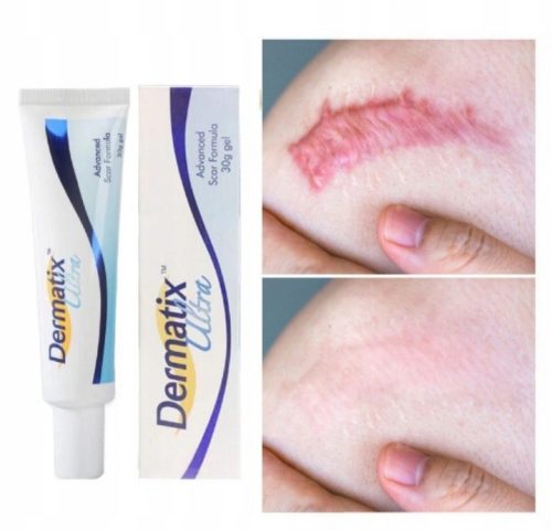 Dermatix Ultra - Silikonski gel za liječenje i prevenciju ožiljaka 15g